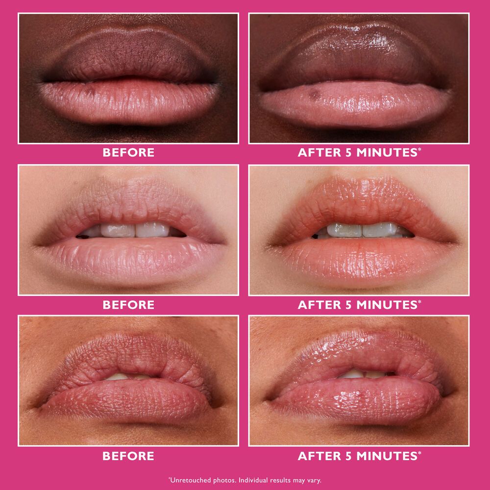 Peter Thomas Roth Instant FIRMx Lip Filler 10ml
